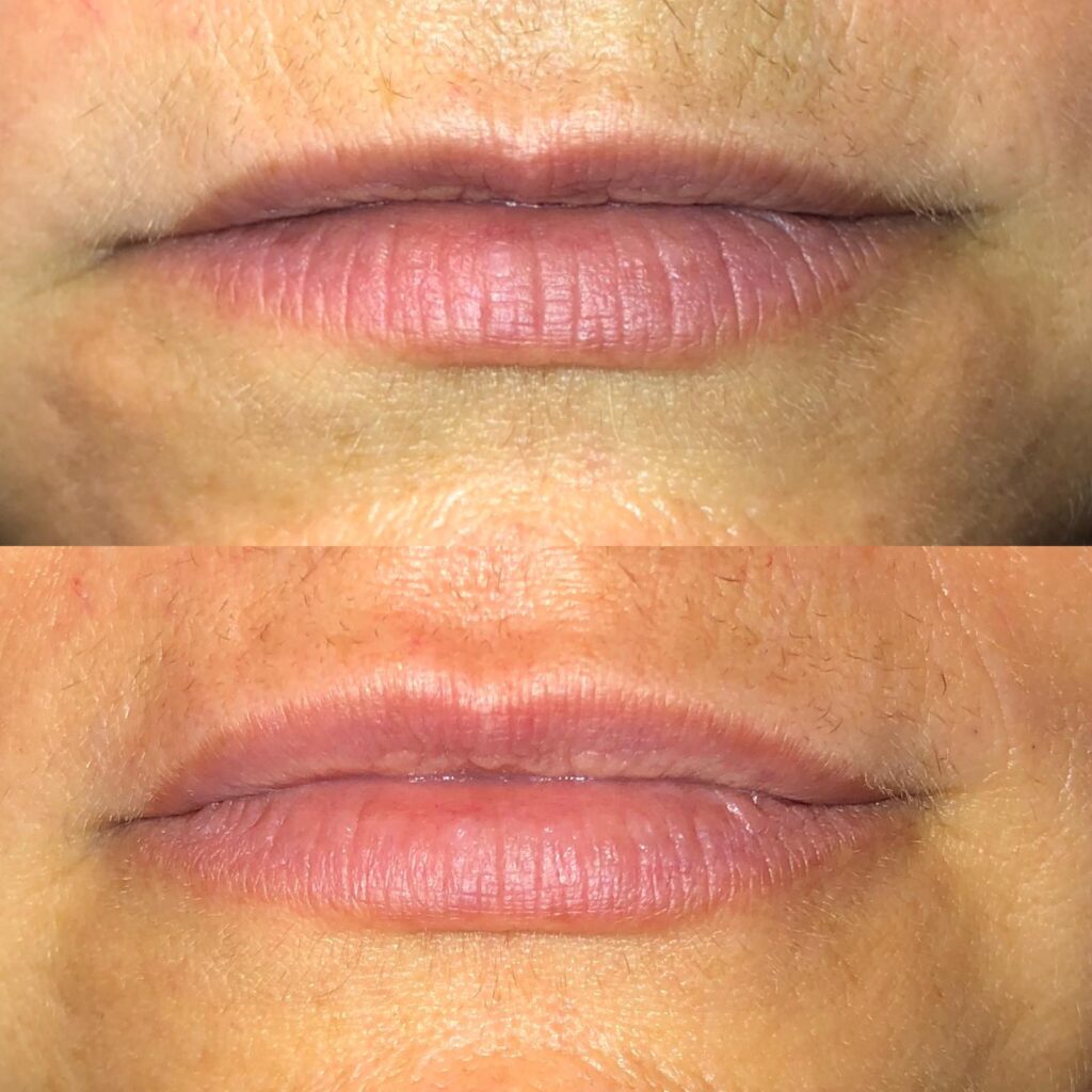 antes y despues
